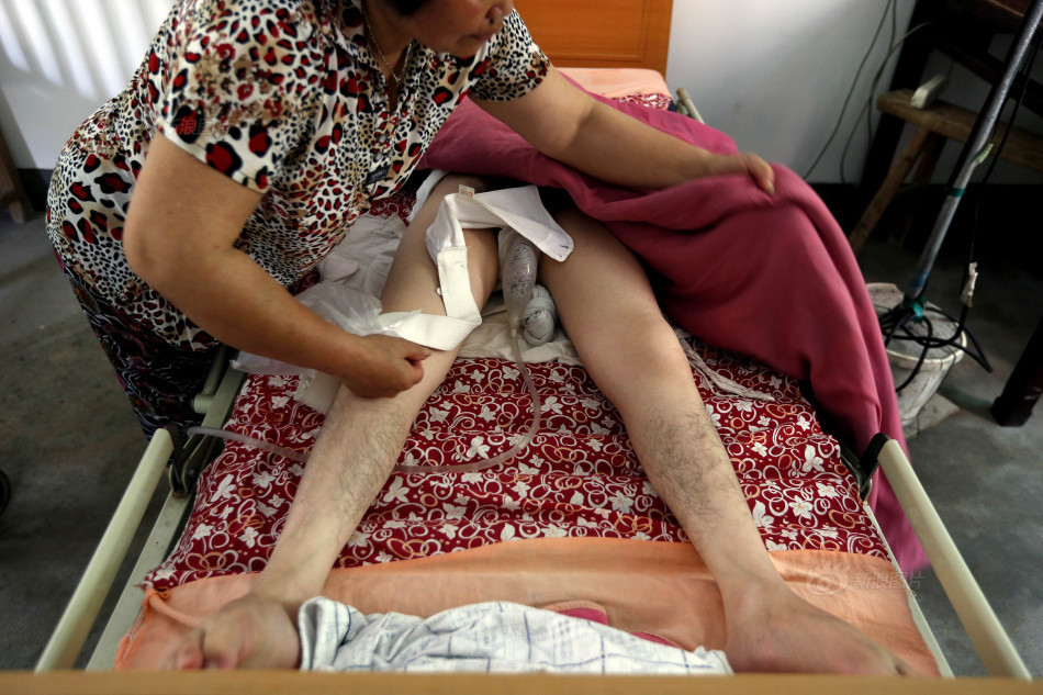 用嘴“咬”出来的人生--中国青年志愿者网